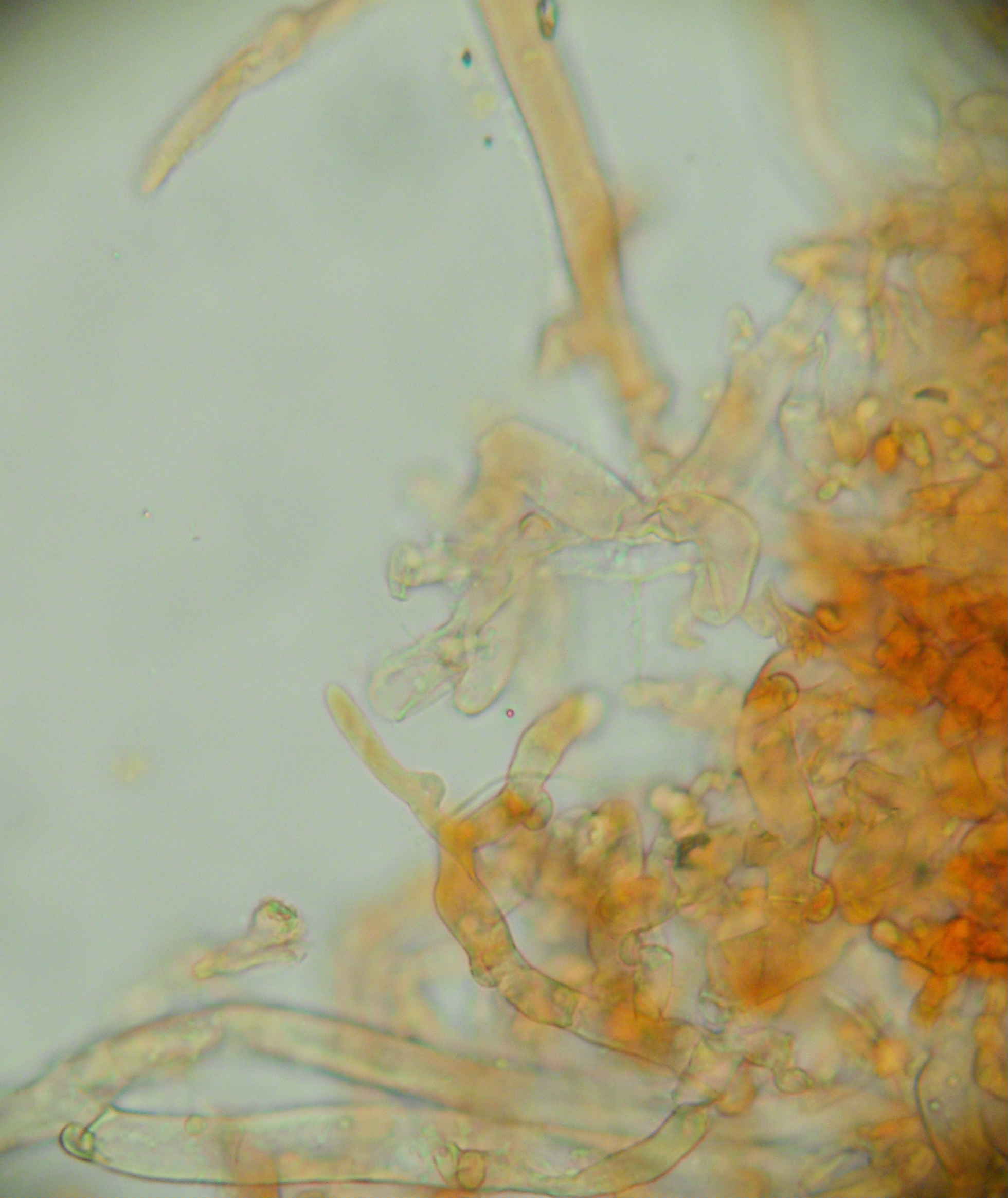 Botryobasidium? (Botryobasidium subcoronatum)